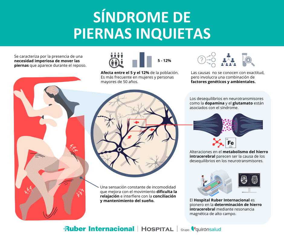 Síndrome de piernas inquietas: Causas, diagnóstico y tratamiento